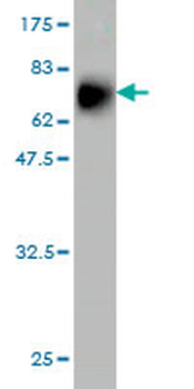 MCM7 monoclonal antibody (M01), clone 6C2