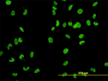 MCM2 monoclonal antibody (M01), clone 6A8