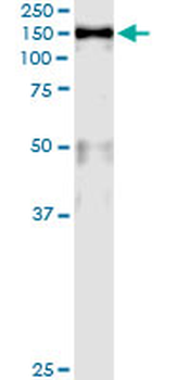 MCM2 monoclonal antibody (M01), clone 6A8