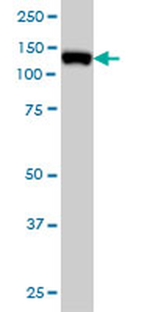 MCM2 monoclonal antibody (M01), clone 6A8