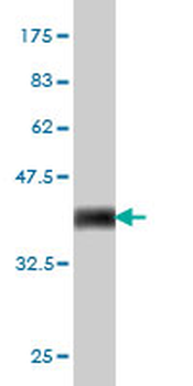 MCM2 monoclonal antibody (M01), clone 6A8