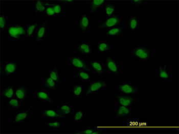 MBNL1 monoclonal antibody (M02), clone 3E7
