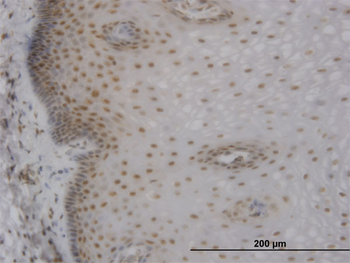 MBNL1 monoclonal antibody (M02), clone 3E7