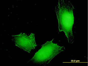 MAGEA4 monoclonal antibody (M01), clone 3D12