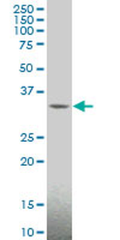 MAGEA4 monoclonal antibody (M01), clone 3D12