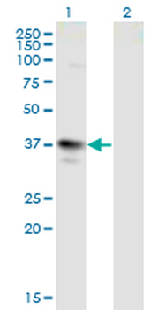 MAGEA3 monoclonal antibody (M01), clone 6D10