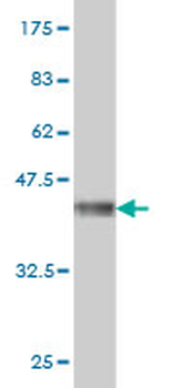 MAGEA3 monoclonal antibody (M01), clone 6D10