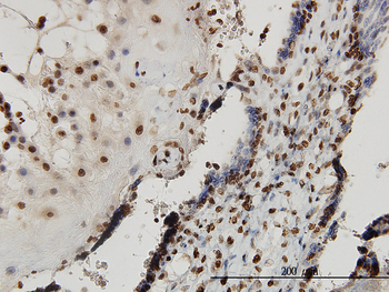SMAD7 monoclonal antibody (M09), clone 1G10