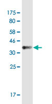 SMAD7 monoclonal antibody (M09), clone 1G10