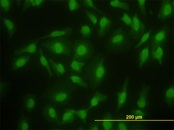 SMAD2 monoclonal antibody (M05), clone 3G9