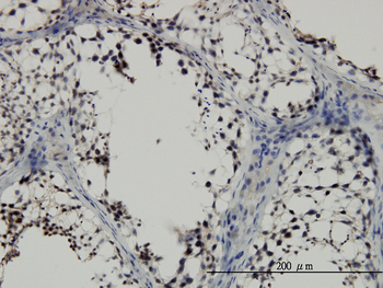 SMAD2 monoclonal antibody (M05), clone 3G9