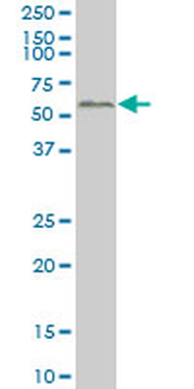 SMAD2 monoclonal antibody (M05), clone 3G9