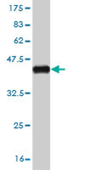SMAD2 monoclonal antibody (M05), clone 3G9