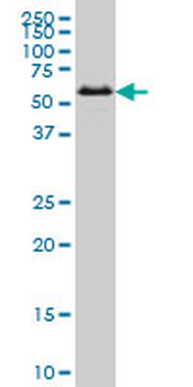 SMAD1 monoclonal antibody (M05), clone 1C7