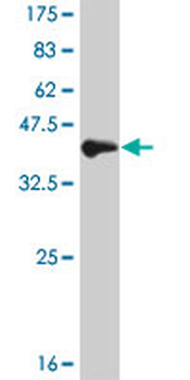 SMAD1 monoclonal antibody (M05), clone 1C7