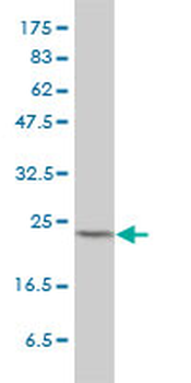 MAD2L1 monoclonal antibody (M01), clone 2E2-1D6