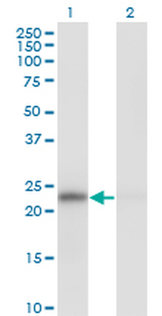 MAD2L1 monoclonal antibody (M01), clone 2E2-1D6