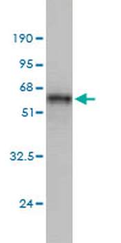 MAD2L1 monoclonal antibody (M01), clone 2E2-1D6