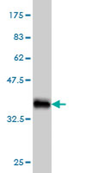 LRP5 monoclonal antibody (M01), clone 1E9