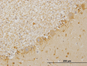 LIMK1 monoclonal antibody (M05), clone 2E9