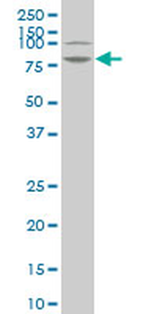 LIMK1 monoclonal antibody (M05), clone 2E9