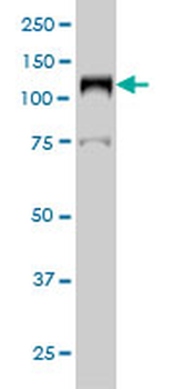 LIG1 monoclonal antibody (M01), clone AG12