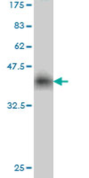 LIG1 monoclonal antibody (M01), clone AG12