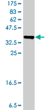LGALS9 polyclonal antibody (A01)