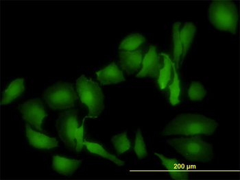 LGALS1 monoclonal antibody (M01), clone 1E8-1B2