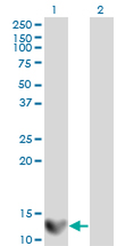 LGALS1 monoclonal antibody (M01), clone 1E8-1B2