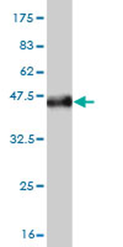 LGALS1 monoclonal antibody (M01), clone 1E8-1B2