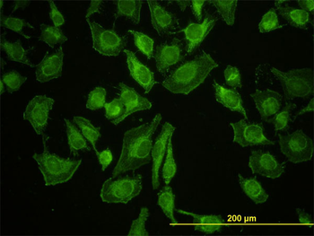 LETM1 monoclonal antibody (M03), clone 6F7