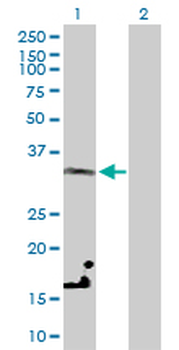LDHC purified MaxPab rabbit polyclonal antibody (D01P)