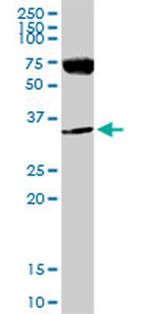 LDHA MaxPab rabbit polyclonal antibody (D01)