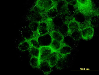 LAMB3 monoclonal antibody (M01), clone 2G10