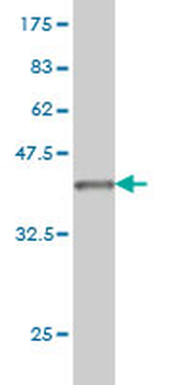 LAMB3 monoclonal antibody (M01), clone 2G10