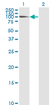 LAMA5 monoclonal antibody (M01), clone 2F7