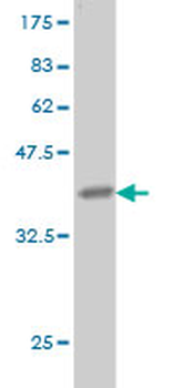 LAMA5 monoclonal antibody (M01), clone 2F7