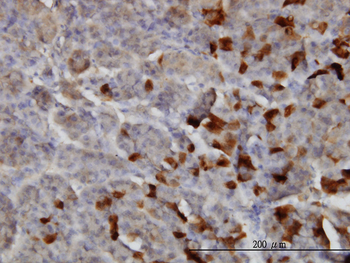 LAMA2 monoclonal antibody (M01), clone 2D4