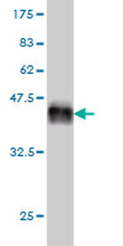 LAMA2 monoclonal antibody (M01), clone 2D4