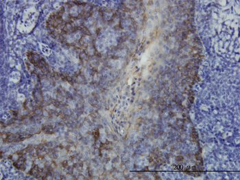 KRT17 monoclonal antibody (M01), clone 2D4-1G9