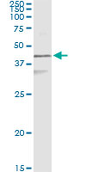 KRT17 monoclonal antibody (M01), clone 2D4-1G9