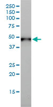 KRT17 monoclonal antibody (M01), clone 2D4-1G9