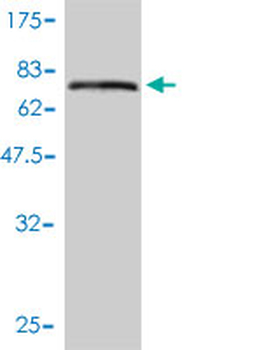 KRT17 monoclonal antibody (M01), clone 2D4-1G9