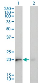 KRAS monoclonal antibody (M02A), clone 4F3