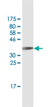 KRAS monoclonal antibody (M02A), clone 4F3