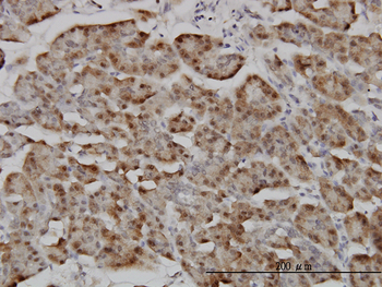 RANBP5 monoclonal antibody (M01), clone 1C4
