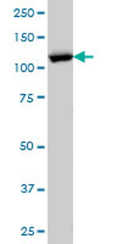 RANBP5 monoclonal antibody (M01), clone 1C4