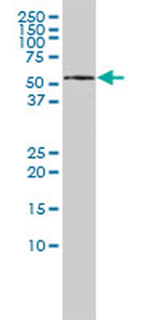 KPNA5 monoclonal antibody (M01), clone 1D2
