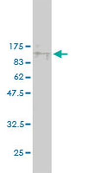 KPNA5 monoclonal antibody (M01), clone 1D2